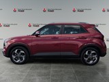 2020 Hyundai Venue Ultimate w/Black Interior image 2