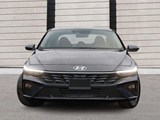 2026 Hyundai Elantra Preferred image 2